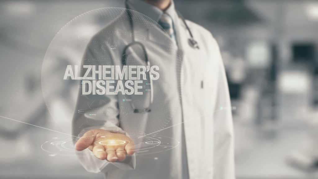Alzheimer’s Research